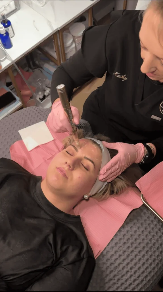 MicroneedlingwithSkinStylus1