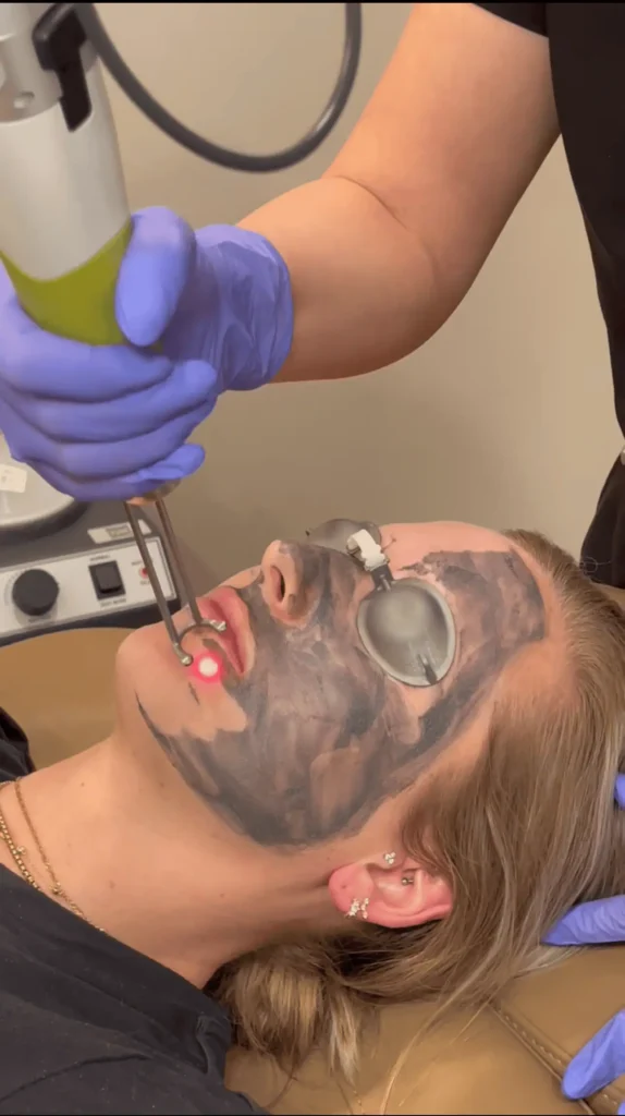 NaturaPeel