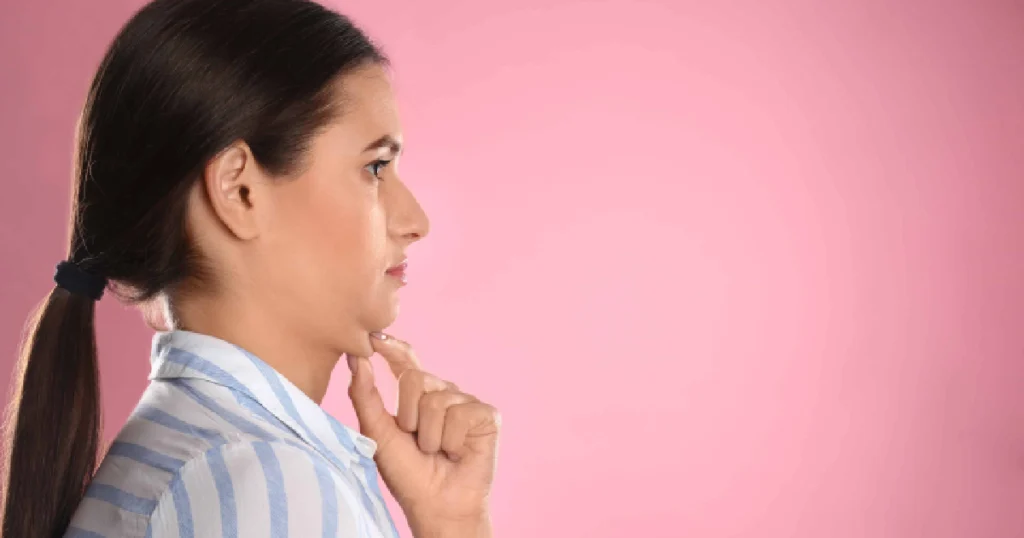 Woman in profile touching her chin, highlighting submental area for Kybella in Columbia, SC