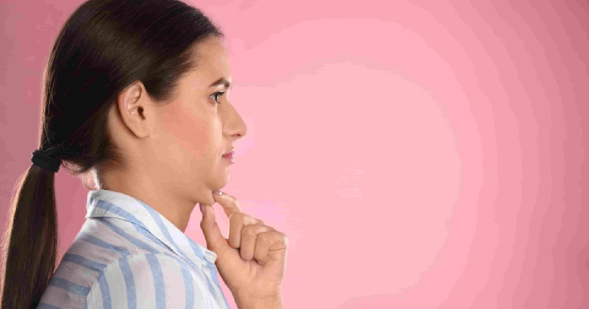 Woman in profile touching her chin, highlighting submental area for Kybella in Columbia, SC