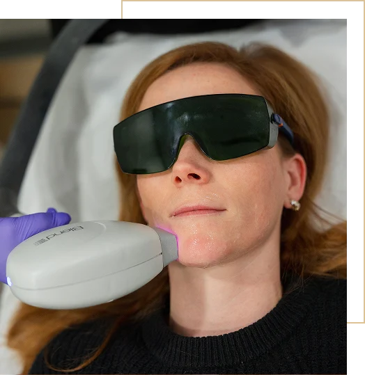 A woman is receiving Laser Hair Removal Treatment at Sculpted by WH Aesthetics in Columbia, SC