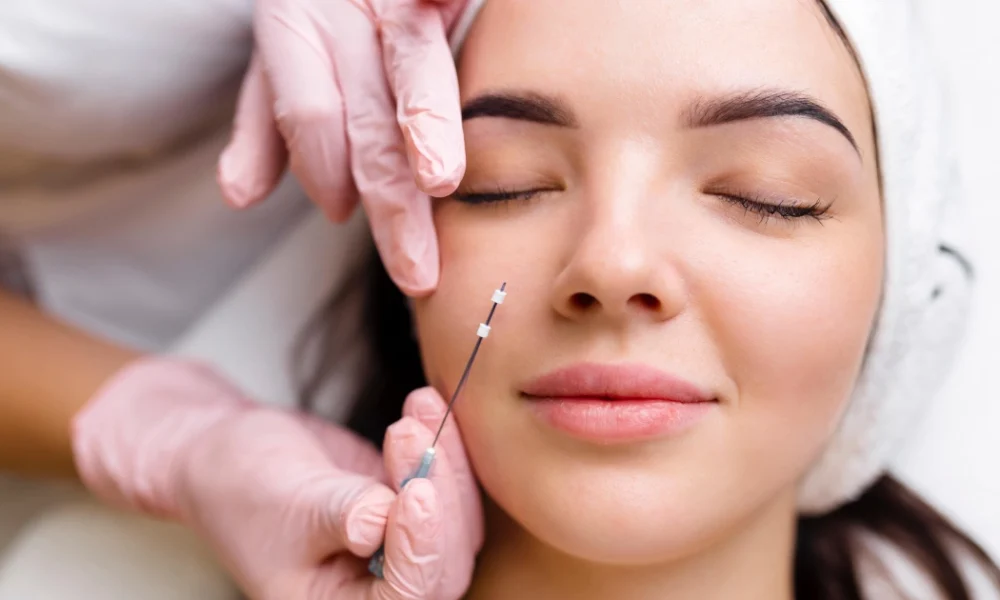 A woman with eyes closed receives a PDO Threads cosmetic treatment in Columbia, SC, as a gloved hand holds a needle near her cheek.