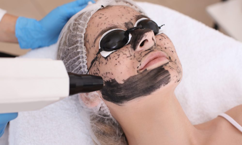 NaturaPeel Laser Facial by Sculpted by WH Aesthetics in Columbia, SC