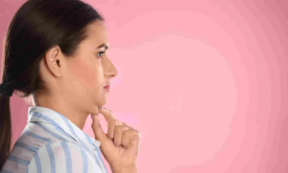 Woman in profile touching her chin, highlighting submental area for Kybella in Columbia, SC